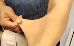 女子得罕见病：皮肤可拉伸如橡皮人 胞姐首例确诊！