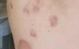 惊呆了！男子理发店充430万 灌肠一疗程30万！