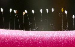 女子发现阳台上的衣架长出草蛉虫卵 究竟怎么回事