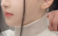 “长相完美”听障女孩植入人工耳蜗 正在进行语训康复!