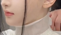 “长相完美”听障女孩植入人工耳蜗 正在进行语训康复!
