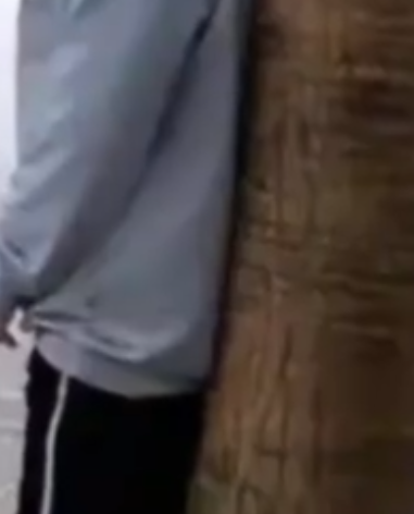 大妈撞树硬核健身差点撞瘫痪 确诊为迟发性创伤后椎体骨坏死！-图1
