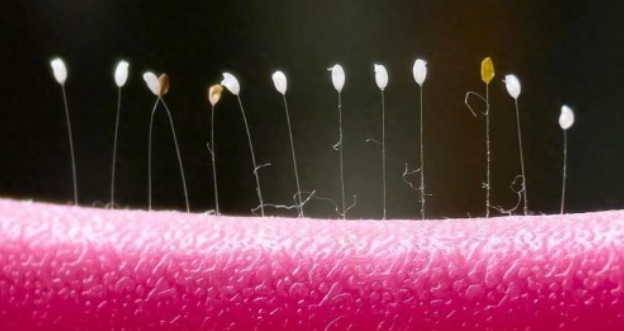女子发现阳台上的衣架长出草蛉虫卵 究竟怎么回事-图1